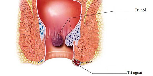 náng hoa trắng chữa bệnh trĩ