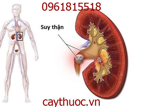 cây phèn đen chữa suy thận