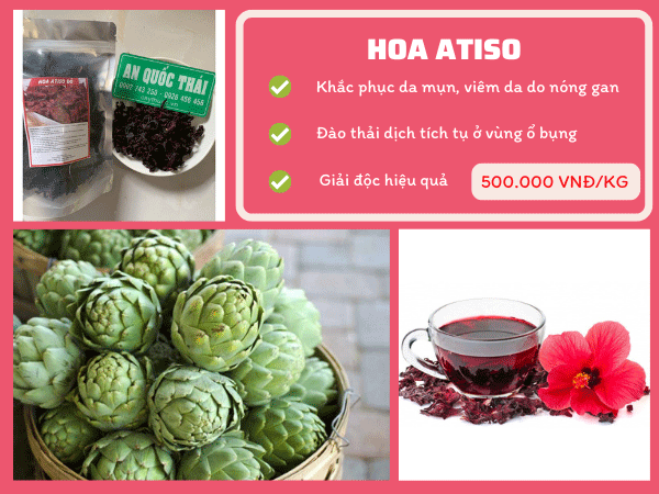 Atiso điều trị bệnh xơ gan