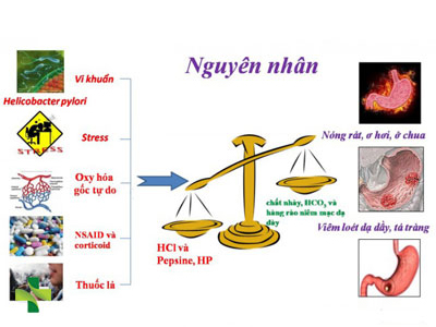 nguyên nhân viêm loét dạ dày