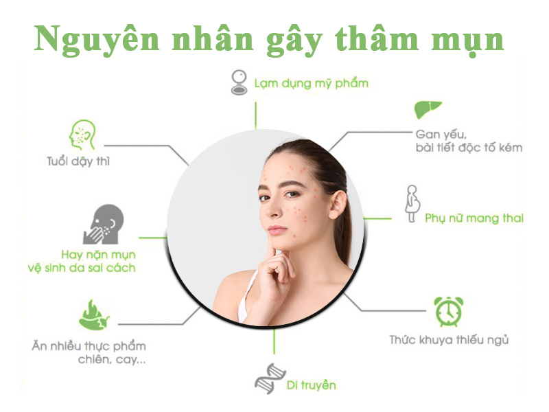 Nguyên nhân gây thâm mụn