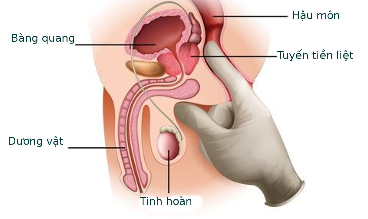 náng hoa trắng chữa tuyến tiền liẹt