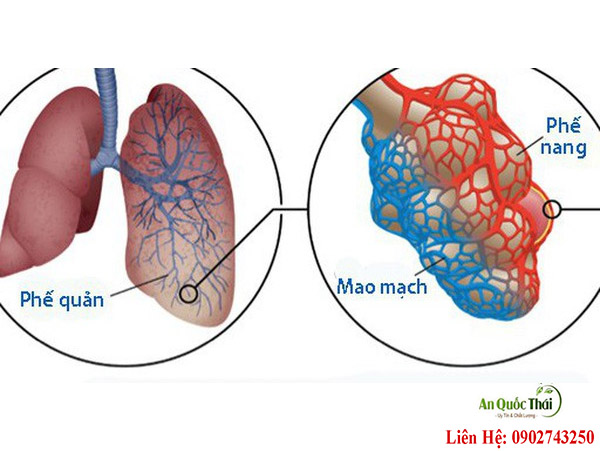 xơ hóa phổi