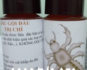 Dầu gội gia truyền trị chấy (chí) đảm bảo diệt tận gốc 100%